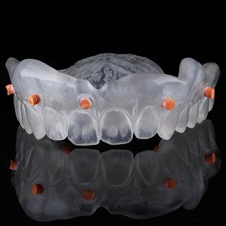 Digital Dentistry Part I: The Art of Underpromising and Overdelivering in Removable Prosthetics