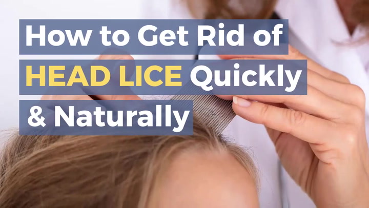 How to Get Rid of Lice & Nits Without Chemicals - Living Well Mom