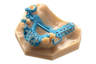 3D Printing in Dentistry