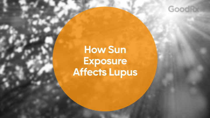 lupus-sun-sensitivity.jpg