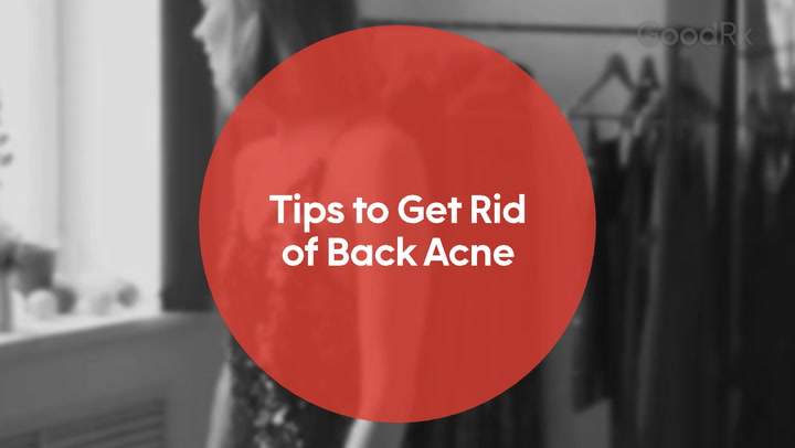 back-acne-solutions-scaled.jpg