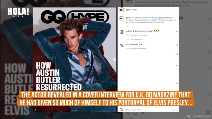 Why Austin Butler was rushed to hospital after wrapping “Elvis”