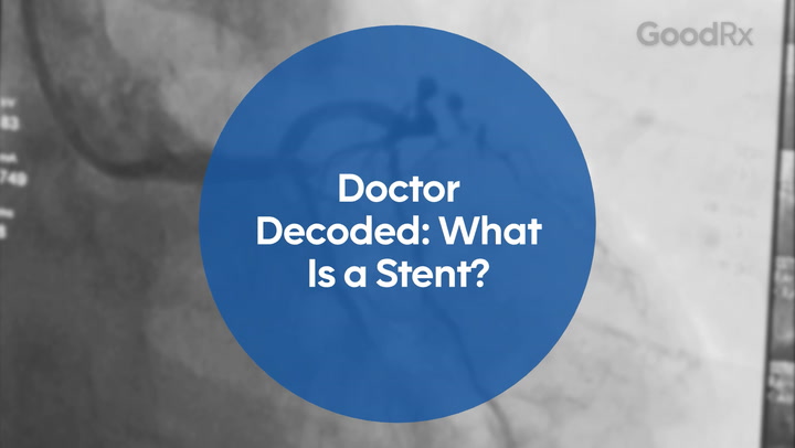 doctor-decoded-stents.jpg