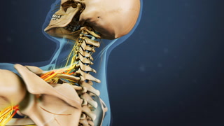 Anterior Cervical Discectomy and Fusion (ACDF) Video | Spine-health