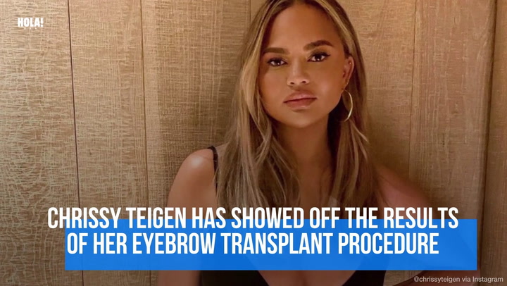 Chrissy Teigen debuts new look after eyebrow transplant surgery