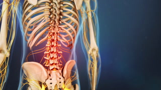 5 Common Causes of Lower Back Pain