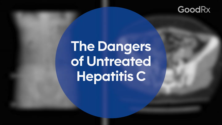 hepatitis-c ꞉ 1293814791